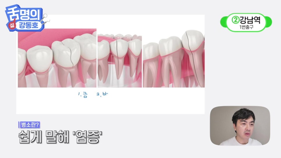 역삼역야간진료치과, 씹을 때마다 아파? 관련 이미지 9