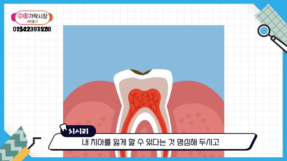 Sillim-dong Dentist — If You Want to Keep Your Natural Teeth for Life image 27