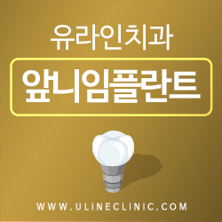 앞니임플란트가격 걱정은 감정낭비 관련 이미지 1