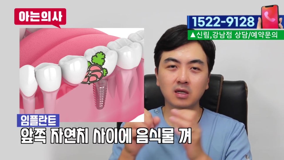 강남역임플란트 후 음식물 왜 끼지? 관련 이미지 20
