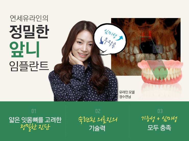 앞니임플란트잘하는곳 정말 중요하죠 관련 이미지 5