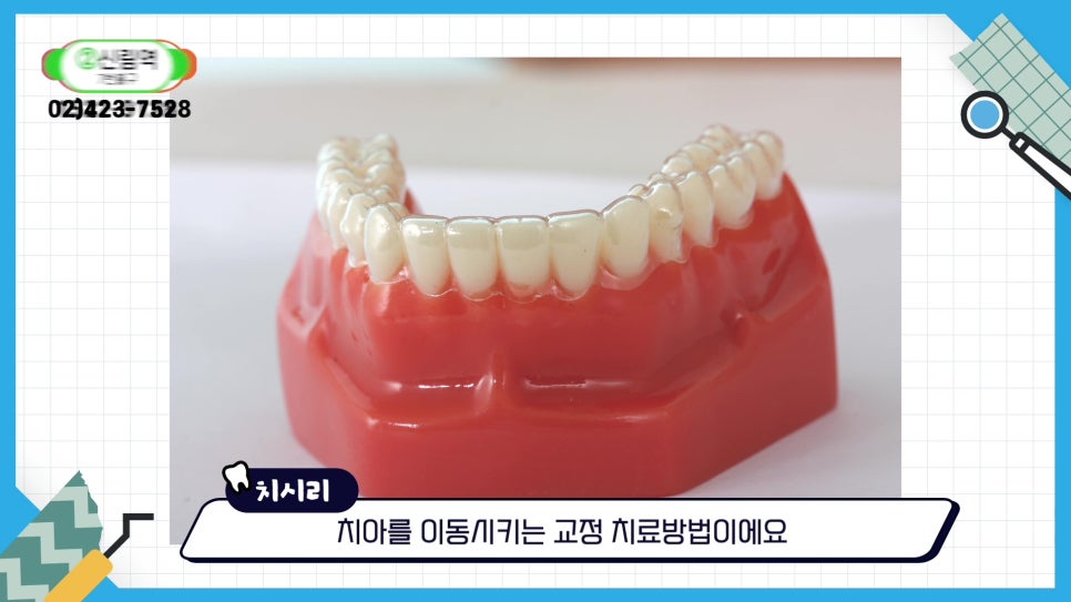 신림동치과 - 안 보이는 투명교정의 모든것 관련 이미지 11
