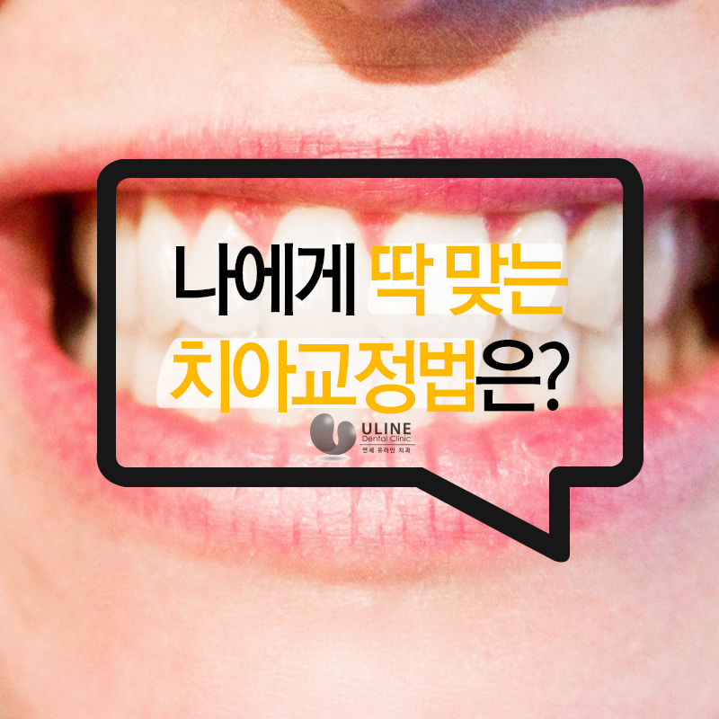 성인치아교정 고민하고계신가요? 관련 이미지 5