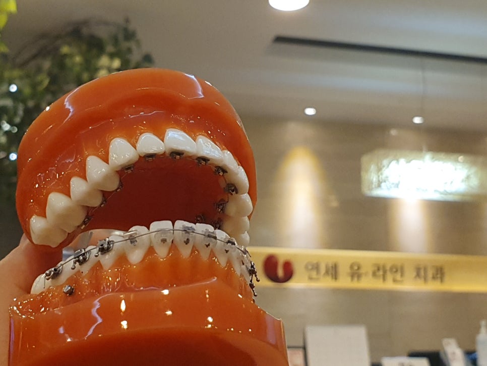 관악구치과 제대로된 솔루션 전달받기 관련 이미지 5
