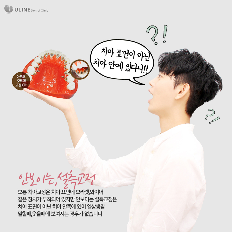 설측교정후기 반해버릴껄! 관련 이미지 3