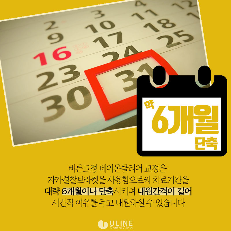 상도동치과 데이몬교정가격 뭐가걱정이야! 관련 이미지 7