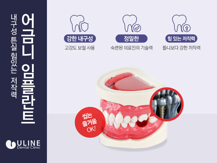 동작구치과 치아없는 불편함을 개선 관련 이미지 4