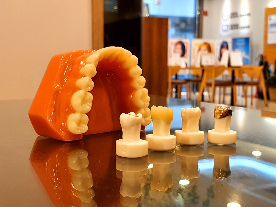 강남역 지르코니아 예쁜 보철물 만나요 관련 이미지 5