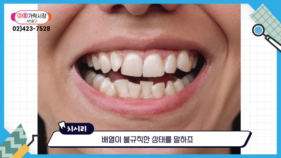 신림치아교정 - 부정교합, 나쁜 ㅇㅇ 때문? 관련 이미지 5