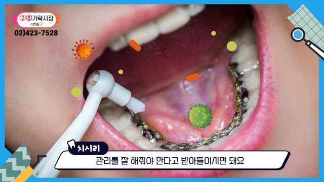 Do Braces Weaken Your Gums? A Fact Check by a Sinlim Dental Clinic image 16