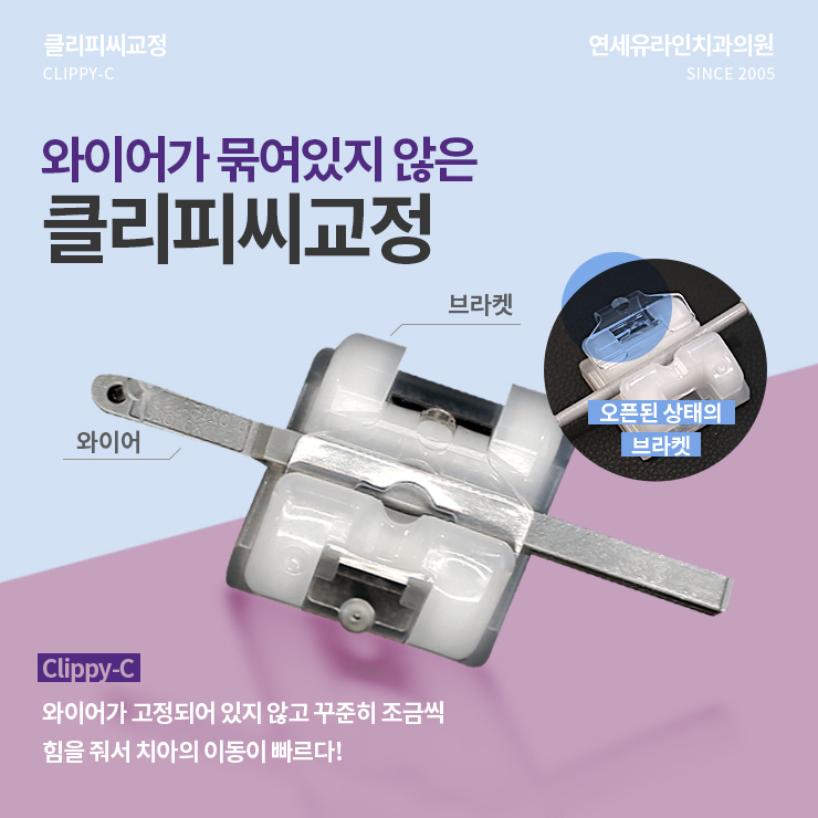 클리피씨교정기간 참, 선택 옳았다! 관련 이미지 4