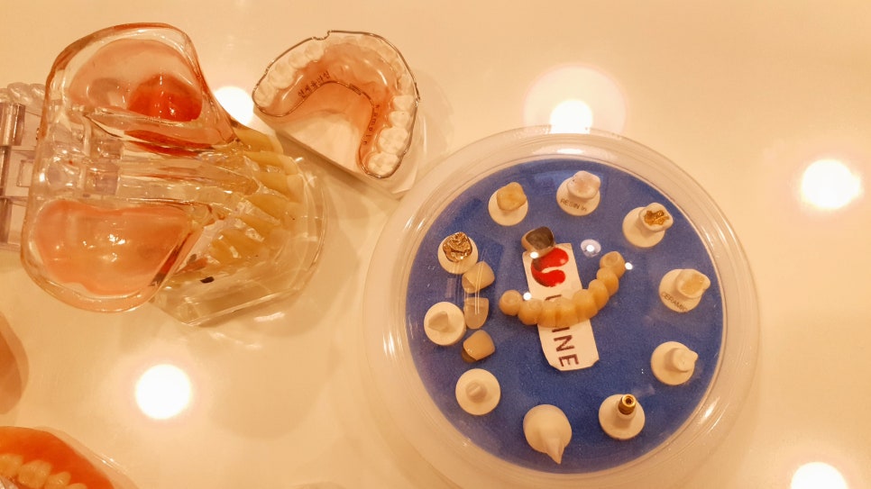 신림역 치아신경치료 자연치를 보호하자 관련 이미지 2