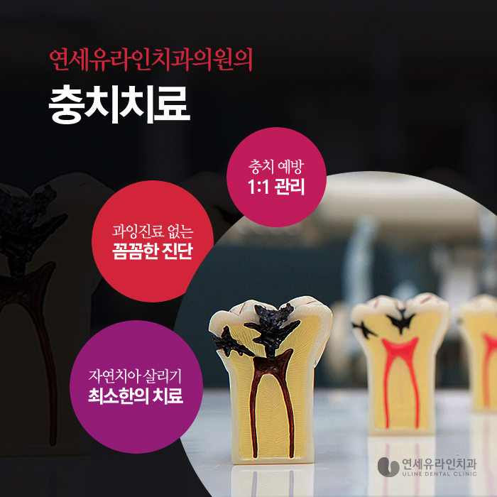 봉천동치과 스케일링 꼭 받는게 좋아요 관련 이미지 8