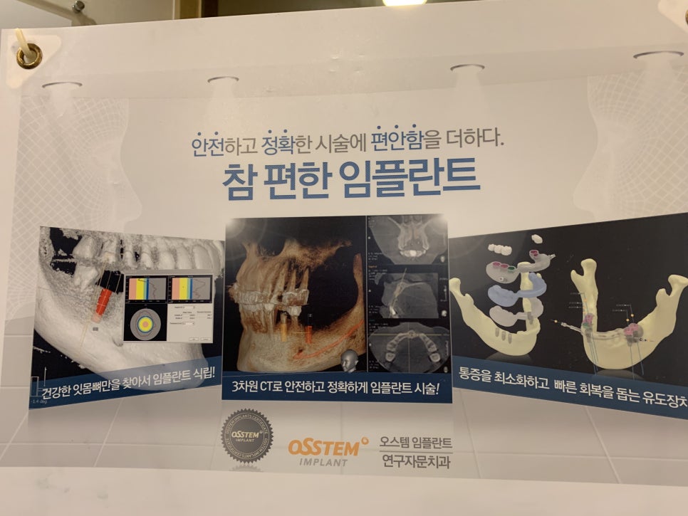 가락동치과 마무리까지 좋아야죠 관련 이미지 3