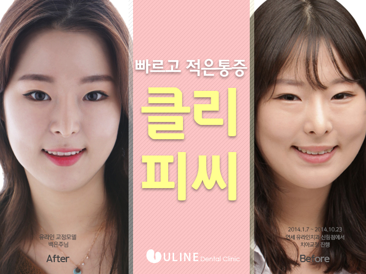 클리피씨교정기간 빠르게 원츄원츄 관련 이미지 6