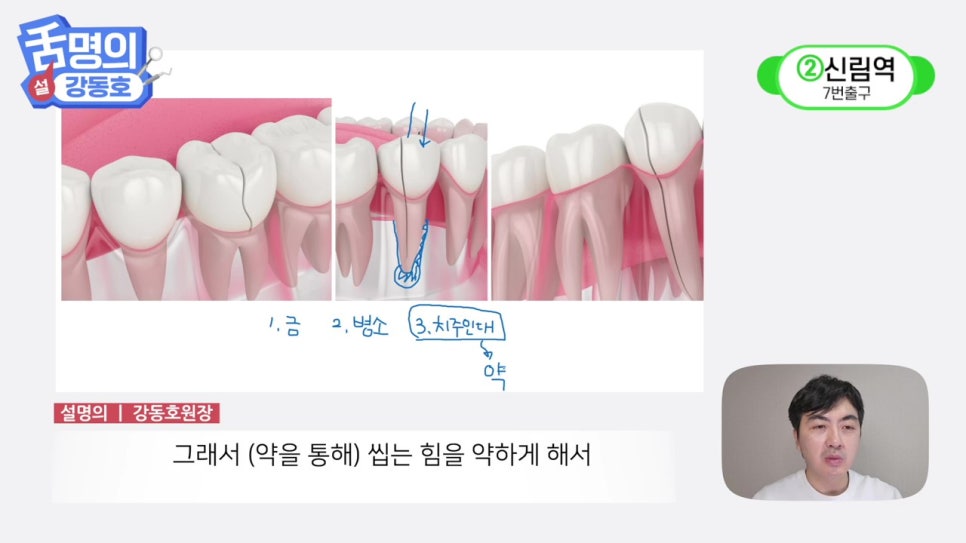 역삼역야간진료치과, 씹을 때마다 아파? 관련 이미지 37