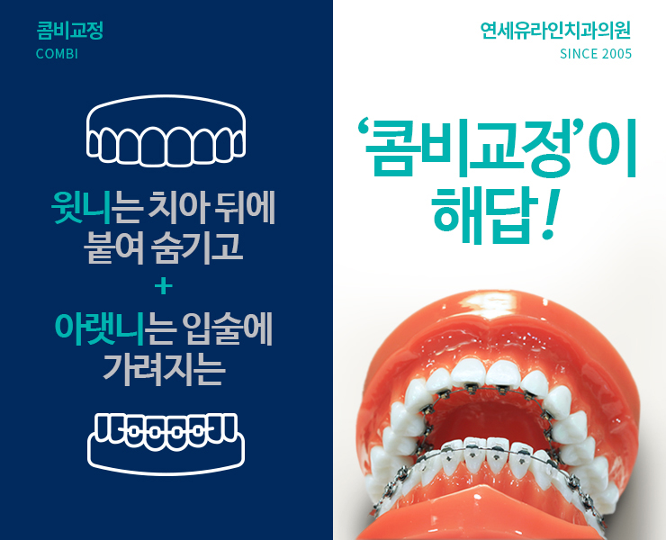 서울대입구역치과 예쁨 빵빵 터져라 관련 이미지 3