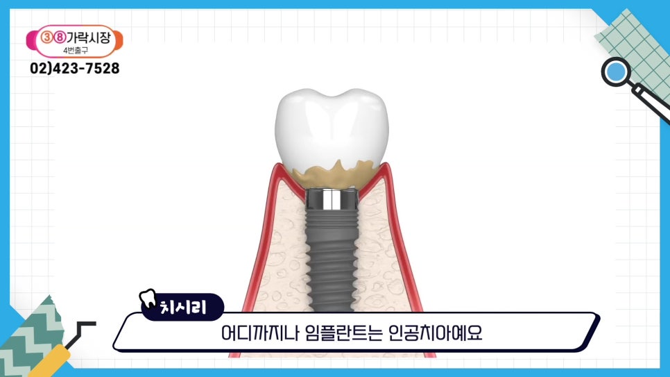 Sillim-dong Dentist — If You Want to Keep Your Natural Teeth for Life image 15