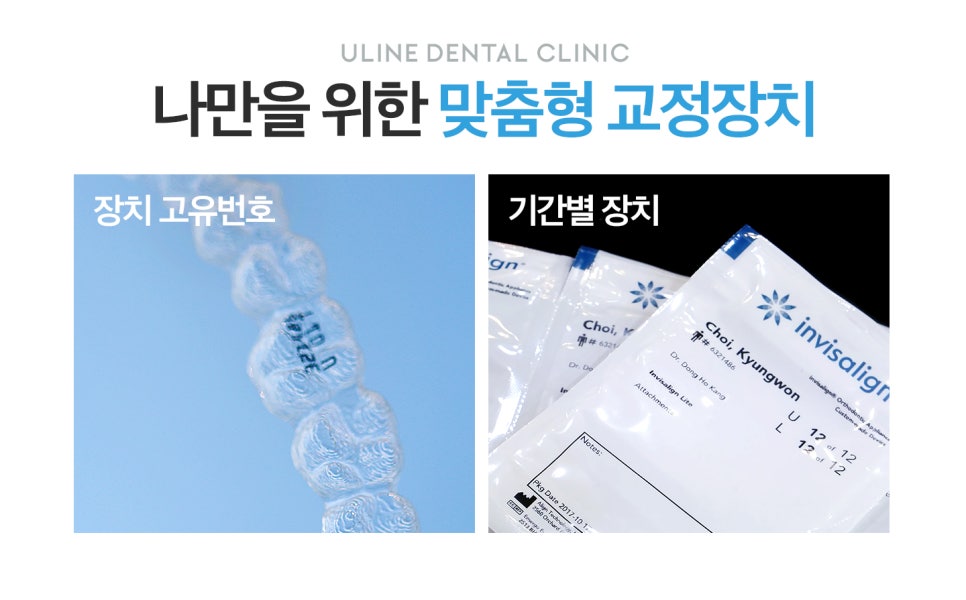 봉천동치과 결혼 예정자도 문제 없죠 관련 이미지 5