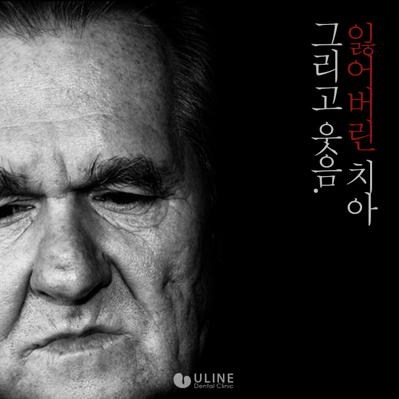 앞니임플란트가격 결과 모두 좋아 관련 이미지 1