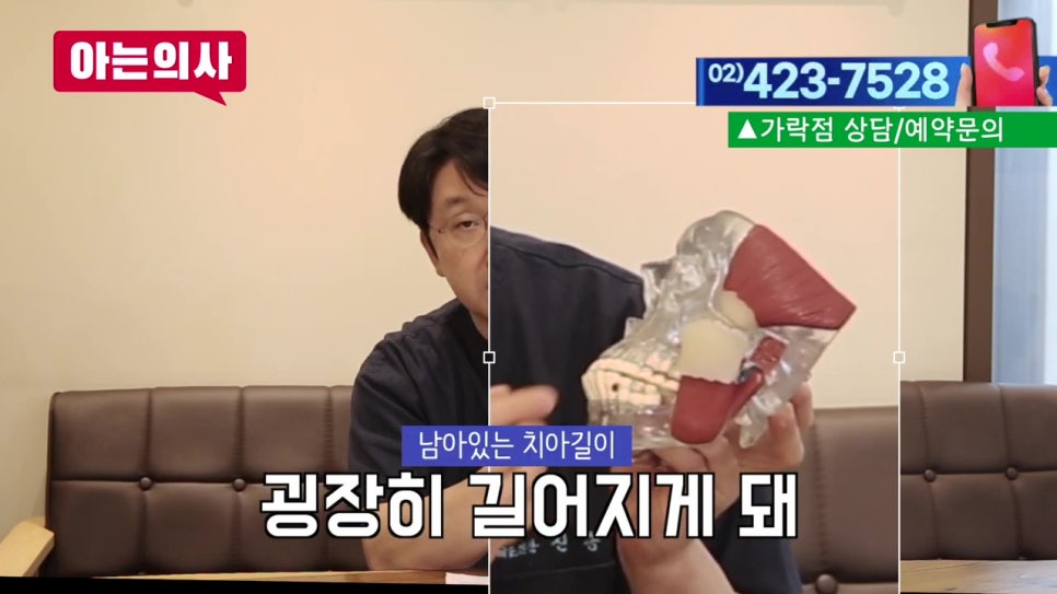 역삼역치과, 임플란트하면 되니.. 관련 이미지 21