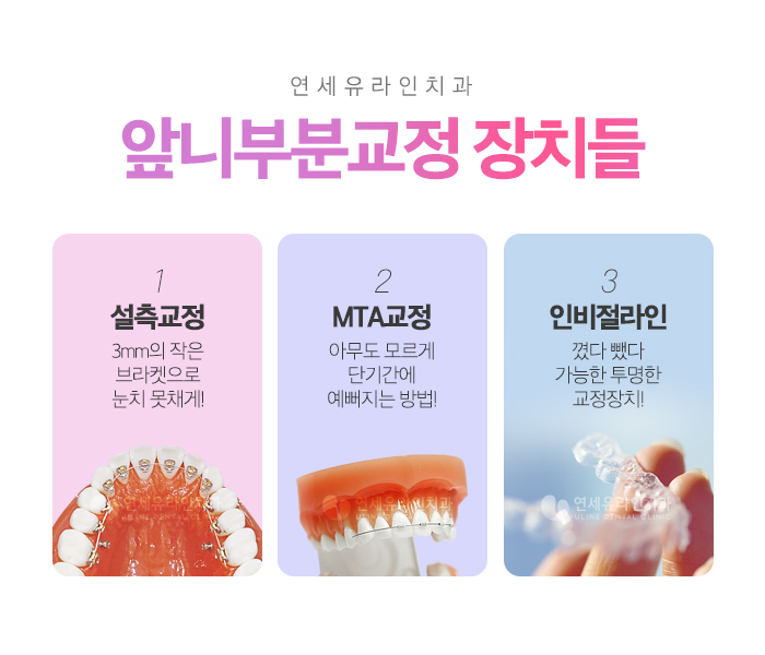 강남역교정치과 변화를 주고 싶은 지금 관련 이미지 4