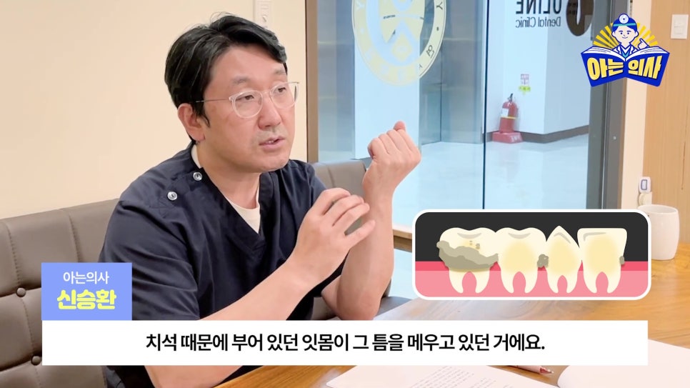 송파구치과 - 잇몸치료와 스케일링 차이는? 관련 이미지 24