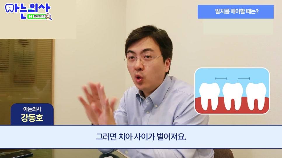 신림동치과 - 흔들리지 않는데 왜 발치하라고 할까? 관련 이미지 13