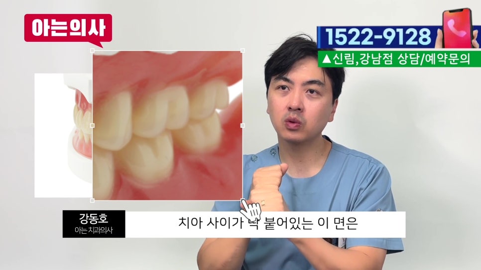 야간진료치과, 치실 아직도 안 써? 관련 이미지 5