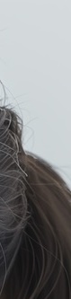 삼성역제모 후 모낭염 원인과 피부 관리 방법 관련 이미지 19
