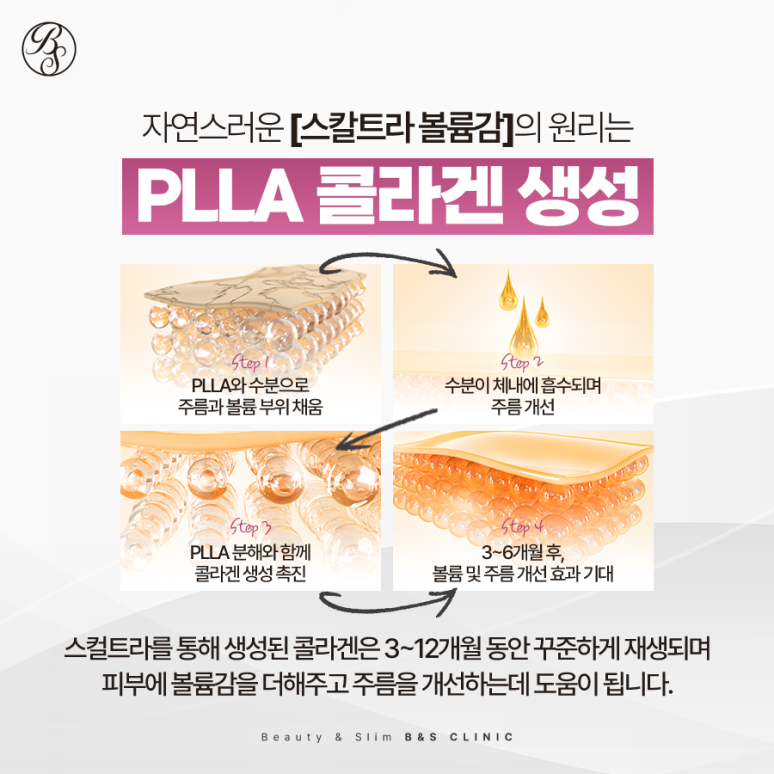 대치역피부과 스컬트라로 콜라겐 쫀쫀! 관련 이미지 4