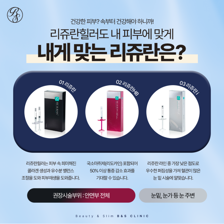 코엑스피부과 쥬베룩볼륨과 스컬트라 꿀팁은? 관련 이미지 5
