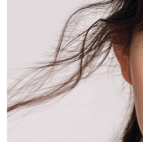 대치동피부과 쥬브젠이 필요한 피부 상태는 어떤 경우일까 관련 이미지 14