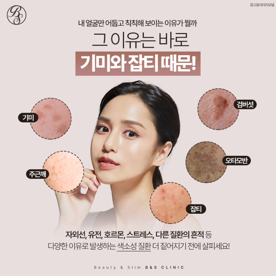 삼성역점제거 레이저로 흔적없이 깔끔하게 관련 이미지 2