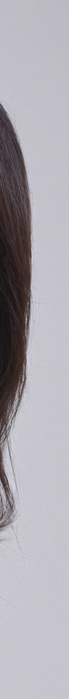 Skin Volume Care with Ulthera at Samsung Station Dermatology image 17