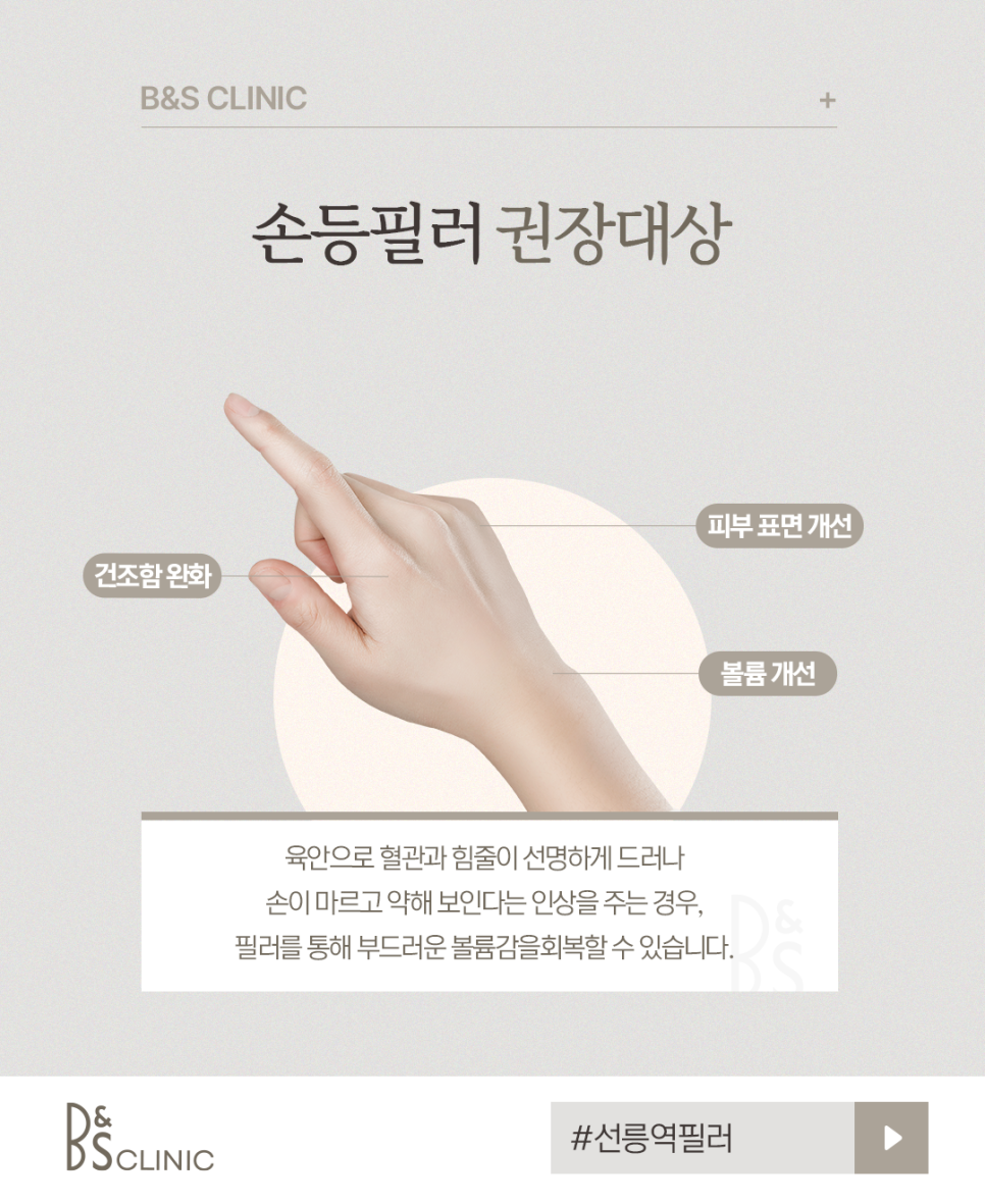 선릉역필러 나이들어 보이는 손등 주름 필러로 매끈하게 관련 이미지 4