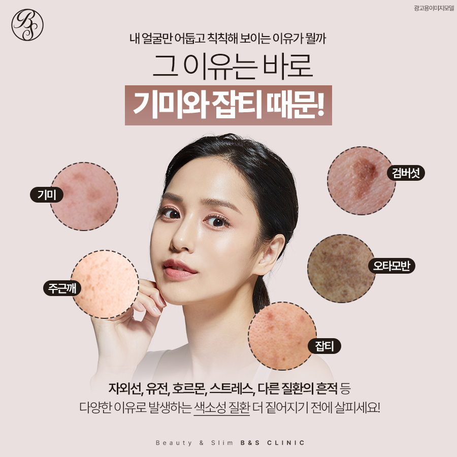 선릉역피부과 짙어지는 색소 마크뷰 진단받고 관련 이미지 2