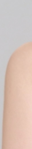 삼성역보톡스 시술 전 알아두면 좋은 정보 관련 이미지 22