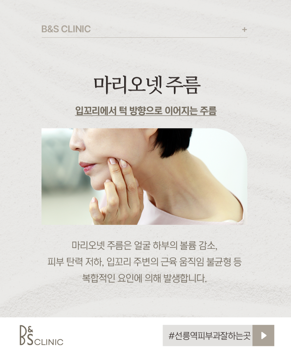 A Good Dermatology Clinic Near Seolleung Station for Marionette Lines image 2