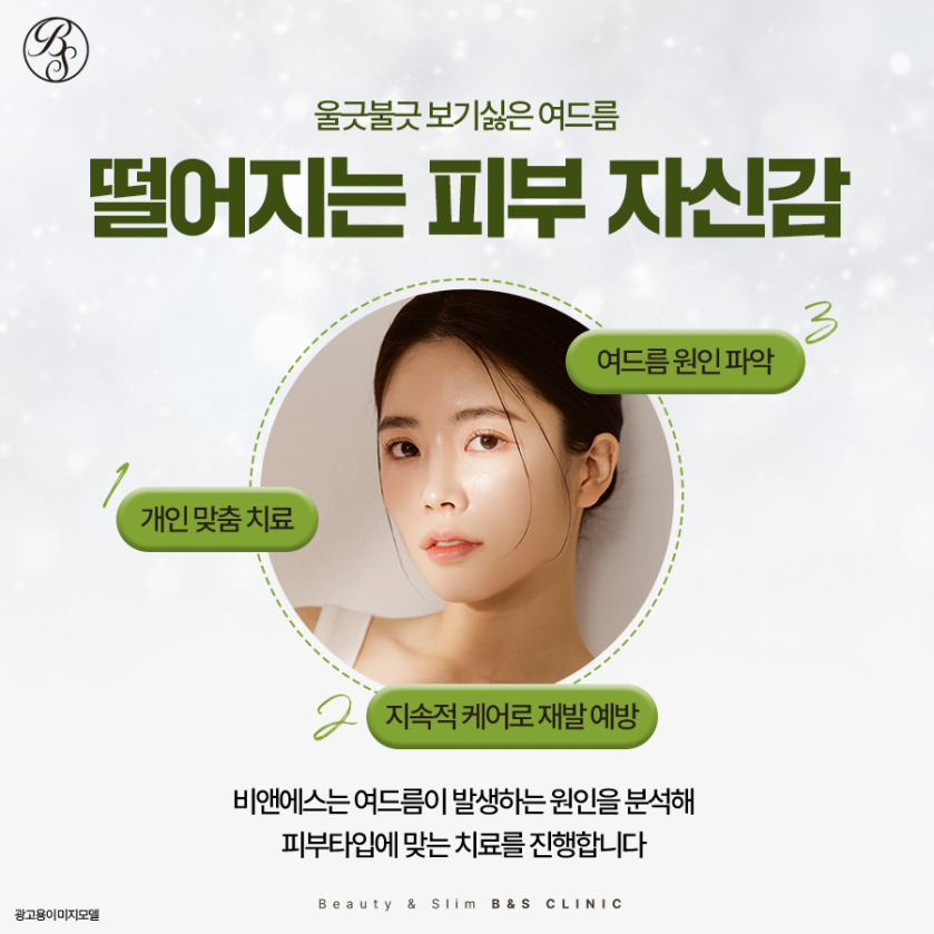 선릉역피부과추천 여드름성 피부가 고민일 때 관련 이미지 4