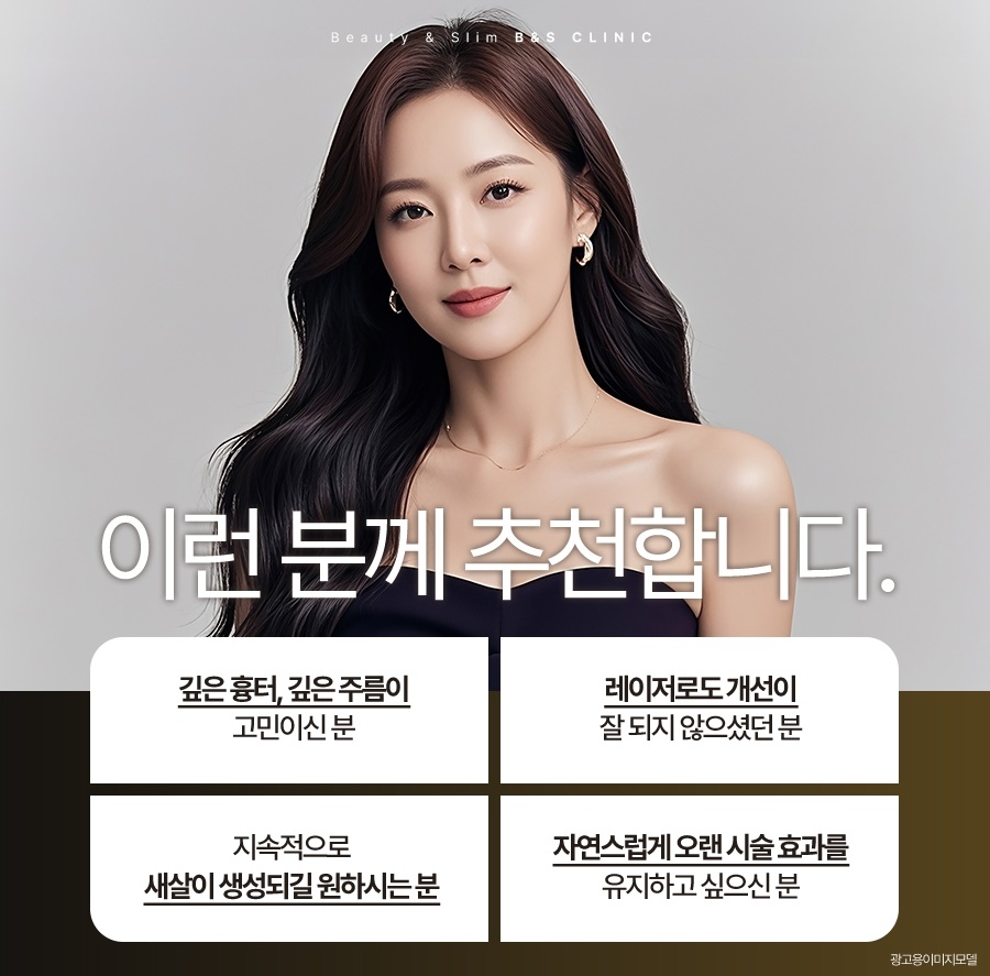 쥬브젠 흉터 시술 전 꼭 알아야 할 사실 관련 이미지 5