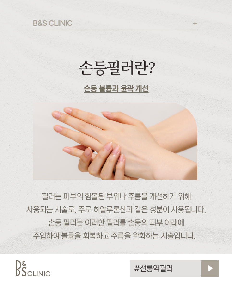 선릉역필러 나이들어 보이는 손등 주름 필러로 매끈하게 관련 이미지 2