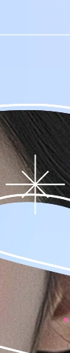 대치동보톡스 간단해보여도 중요하게 관련 이미지 21