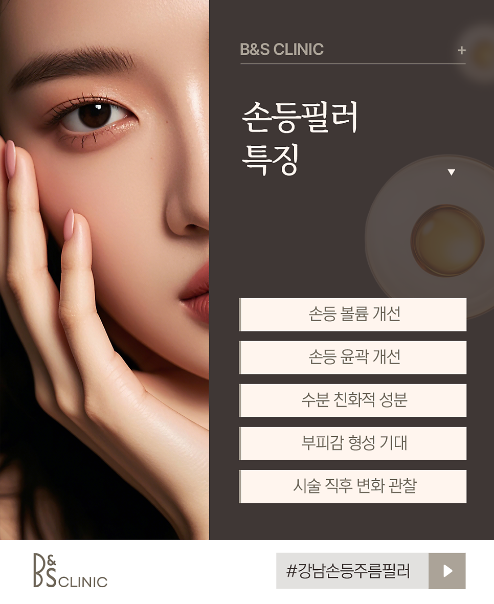 Gangnam Hand Wrinkle Filler: What to Check When You’re Concerned About Wrinkles on the Back of the Hands image 5