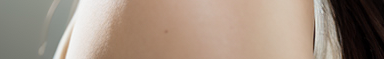 삼성역피부과 울쎄라 리프팅 효과 정리 관련 이미지 36
