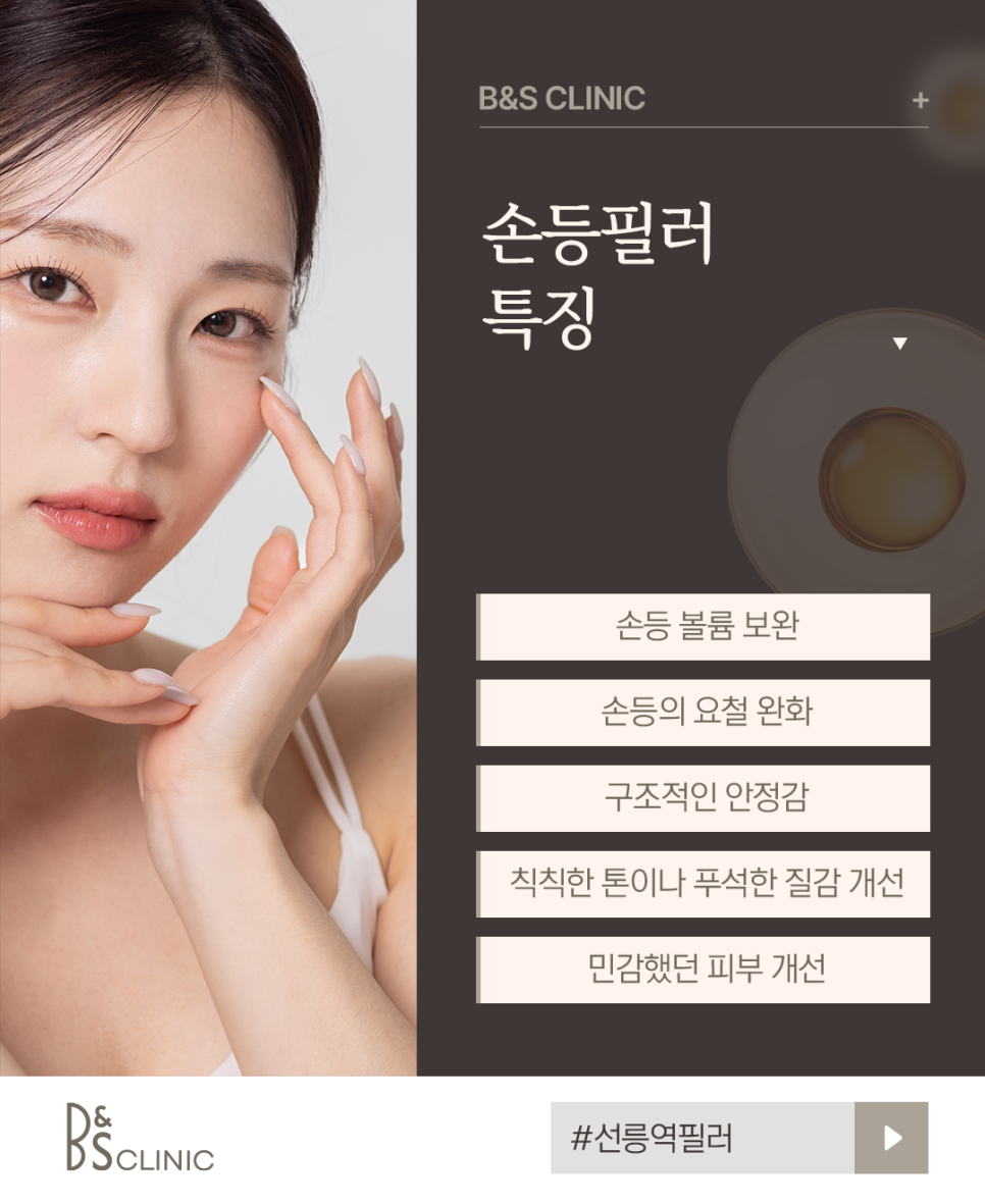 선릉역필러 나이들어 보이는 손등 주름 필러로 매끈하게 관련 이미지 3