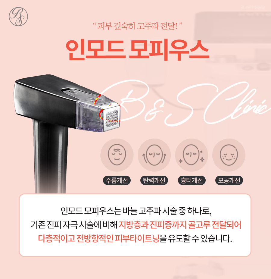 코엑스피부과 인모드 모피우스8 효과와 주의사항까지 관련 이미지 7