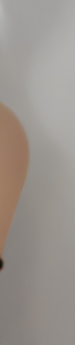 Samsung-dong Botox: From Procedure Principles to Effects image 28