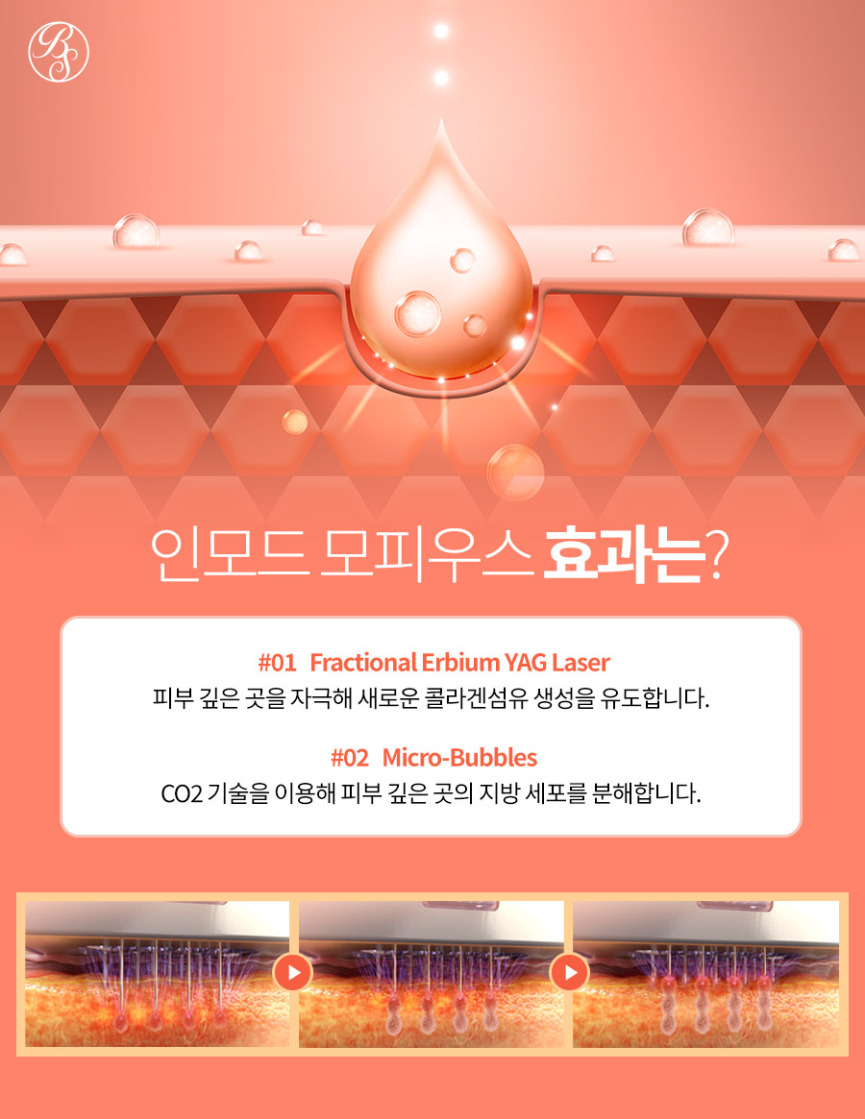 삼성역인모드 탄력 변화부터 다르게 느껴요 관련 이미지 5