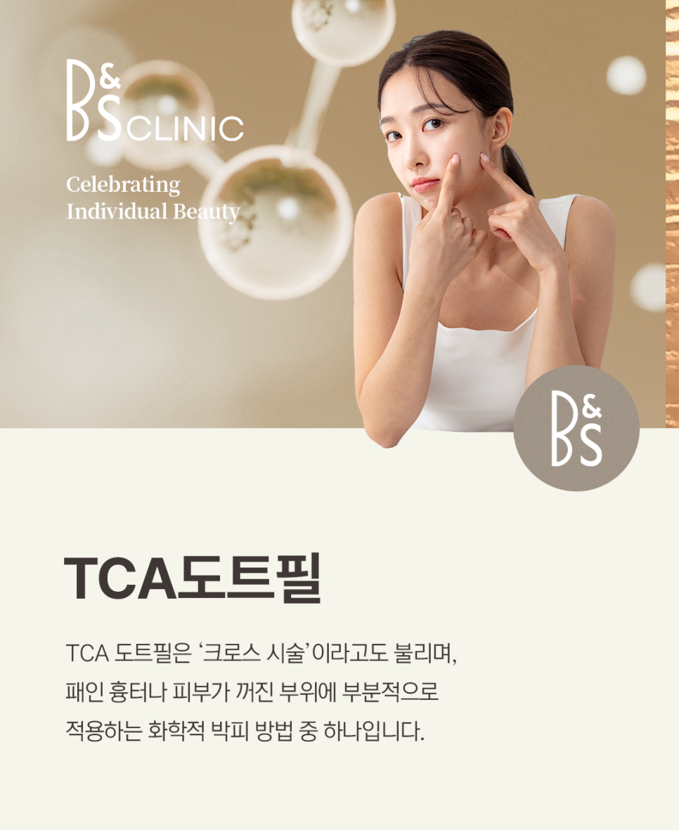 Gangnam-gu Scar Treatment: What Helps Improve Depressed Marks image 4
